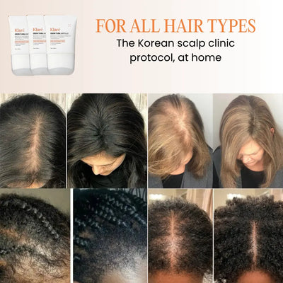#1 Korean Exoscalp Hair Serum